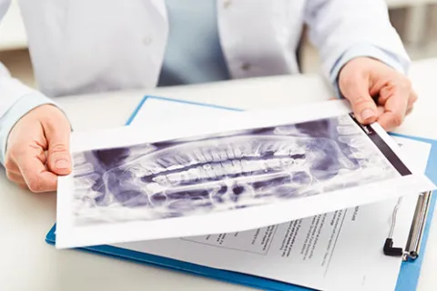 Easy Ways You Can Prevent a Cavity