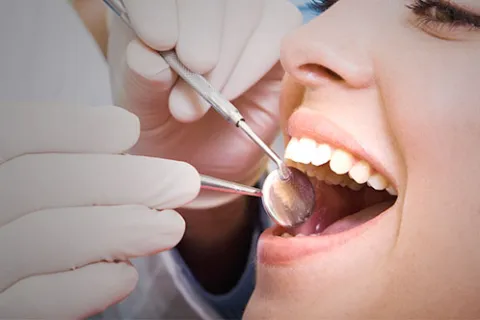 5 Great Reasons to Join Our Dental Membership Club